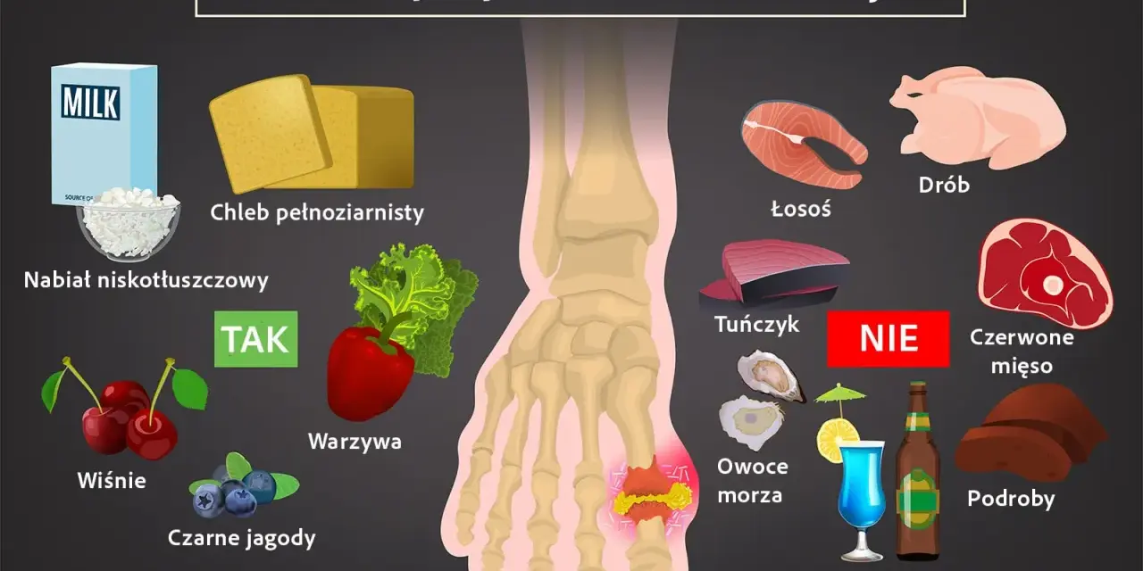 Dieta przy dnie moczanowej: TAK - nabiał, chleb, warzywa, wiśnie, jagody. NIE - drób, łosoś, tuńczyk, czerwone mięso, podroby, alkohol. Witamina B12 jest ważna.
