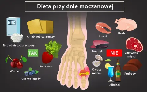 Dieta przy dnie moczanowej: TAK - nabiał, chleb, warzywa, wiśnie, jagody. NIE - drób, łosoś, tuńczyk, czerwone mięso, podroby, alkohol. Witamina B12 jest ważna.