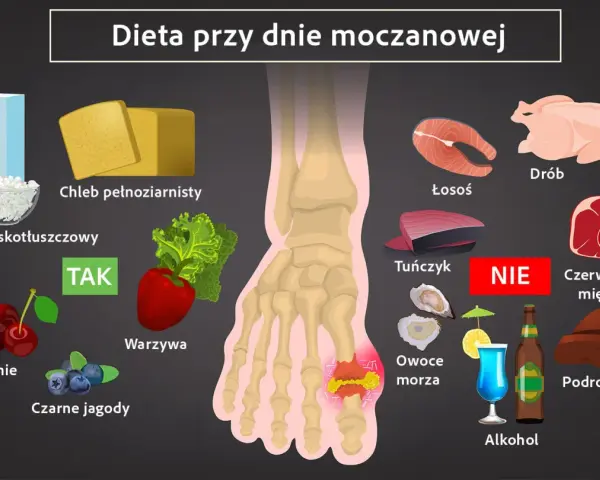 Dieta przy dnie moczanowej: TAK - nabiał, chleb, warzywa, wiśnie, jagody. NIE - drób, łosoś, tuńczyk, czerwone mięso, podroby, alkohol. Witamina B12 jest ważna.