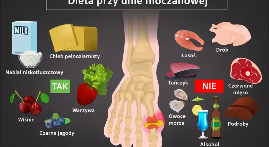 Dieta przy dnie moczanowej: TAK - nabiał, chleb, warzywa, wiśnie, jagody. NIE - drób, łosoś, tuńczyk, czerwone mięso, podroby, alkohol. Witamina B12 jest ważna.
