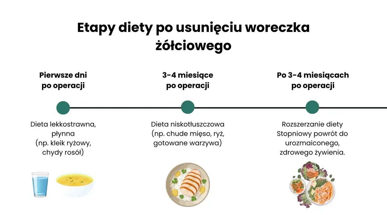 Etapy diety po usunięciu woreczka ż&oacute;łciowego: płynna, niskotłuszczowa, a potem powr&oacute;t do zdrowego żywienia.