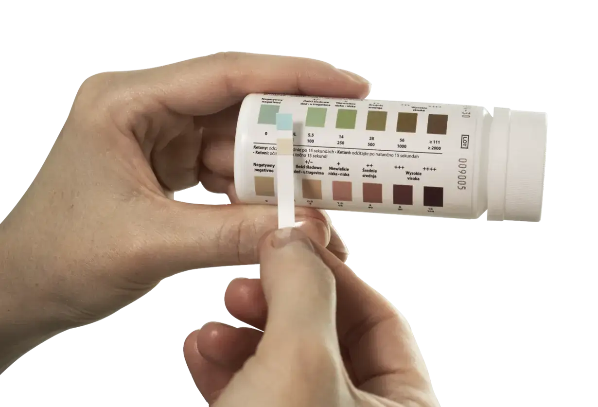 Test paskowy do badania moczu, pokazujący r&oacute;żne poziomy keton&oacute;w. Pasek testowy jest por&oacute;wnywany z kolorową skalą.