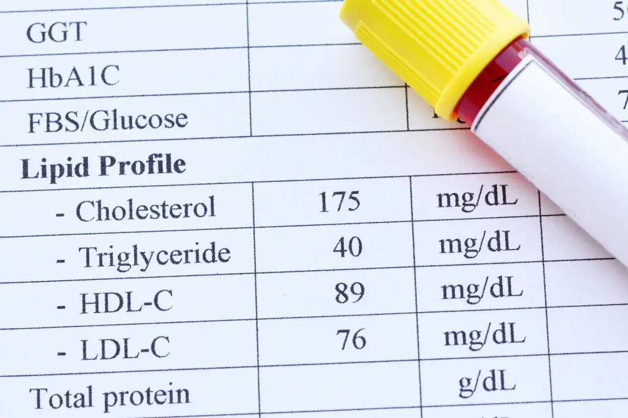 Wynik lipidogramu: tr&oacute;jglicerydy 40 mg/dL, co mieści się w normie. Obok prob&oacute;wka z krwią.