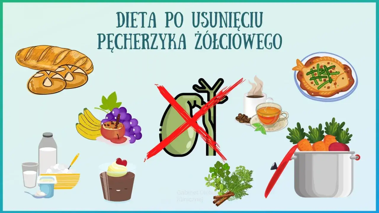 Grafika przedstawia zalecenia żywieniowe: dieta po usunięciu woreczka żółciowego. Widoczne są produkty dozwolone (owoce, warzywa, nabiał) i zakazane (chleb, kawa, ryba).