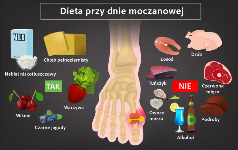 Dieta przy dnie moczanowej: TAK - nabiał, chleb, warzywa, wiśnie, jagody. NIE - drób, łosoś, tuńczyk, czerwone mięso, podroby, alkohol. Witamina B12 jest ważna.